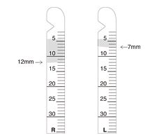 tear volume test|how to measure tears in eyes.